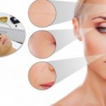 Mecanismele terapeutice in terapia cu oxigen hiperbaric