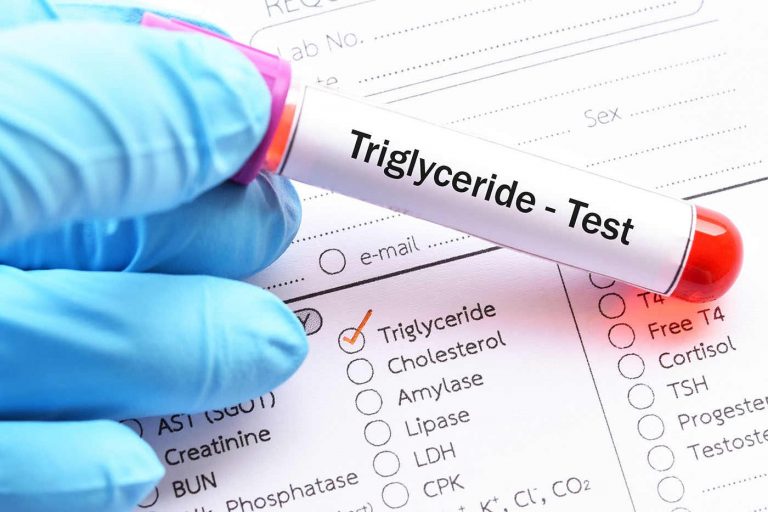 Metode de a reduce trigliceridele cu modificări ale stilului de viață