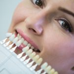 Ce trebuie sa stii inainte de a-ti pune fatete dentare?